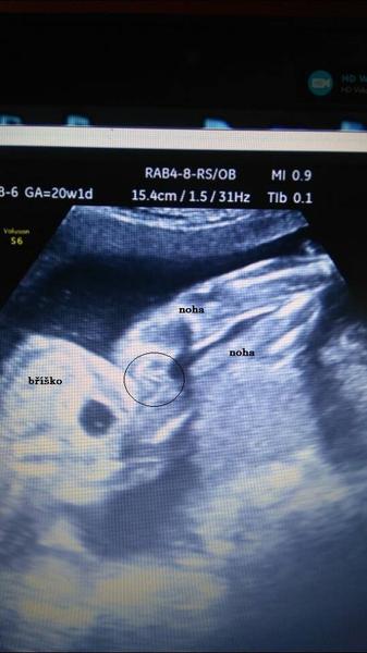 Holky, co myslíte, holka nebo kluk?