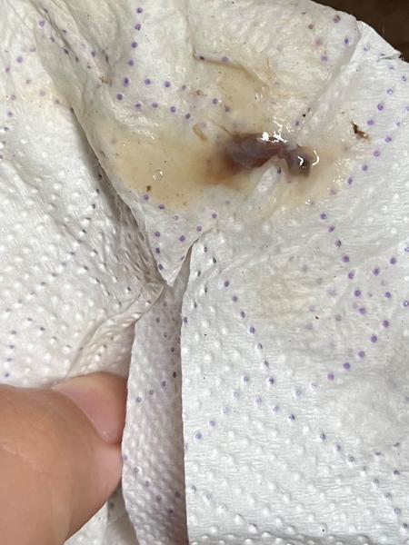 Od kdy odchází hlenová zátka a jak to vypadá?