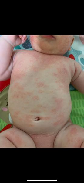 Je to kvasinka nebo něco jiného?