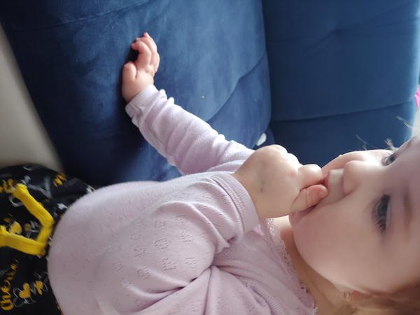 Modřina. Poradíte, prosím?