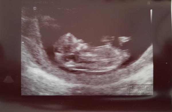 Holčička nebo chlapeček?