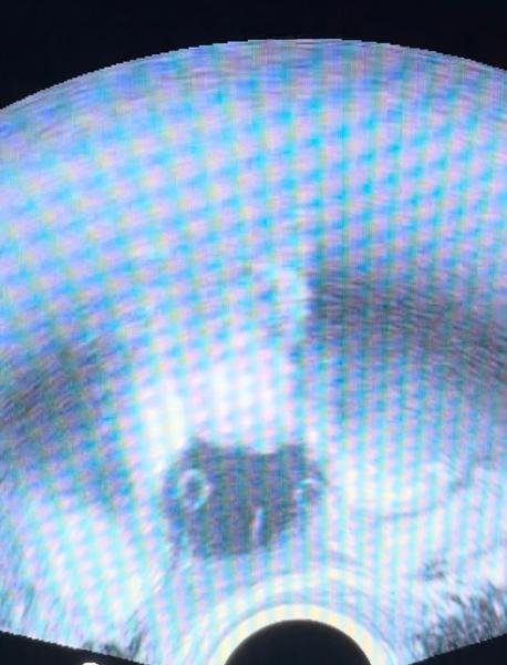 Je možné mít gestační váček i při negativním testu?