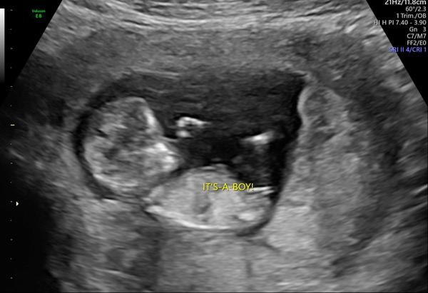 Vážně kluk? Co myslíte?