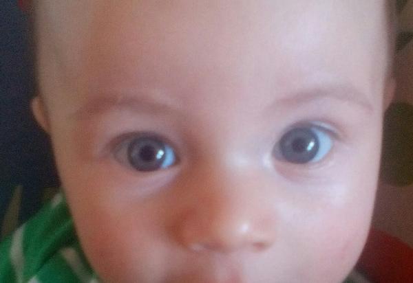 Jak vypadají očička než zhnědnou nebo zmodrají?