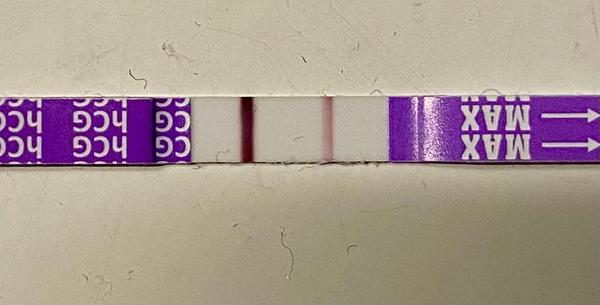 Co lze vidět na ultrazvuku při časném těhotenství?