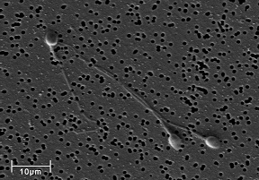 Mesa - odsátí spermií z nadvarlete