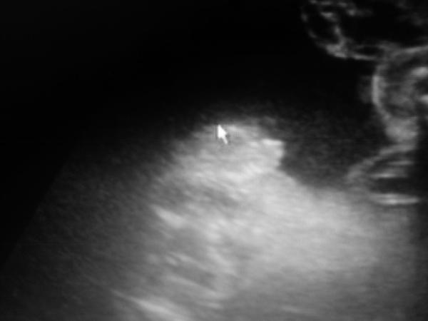 Určení pohlaví, čemu mám věřit?