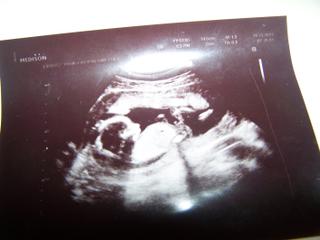 Myslíte, že to může být holčička nebo je to jasný kluk?