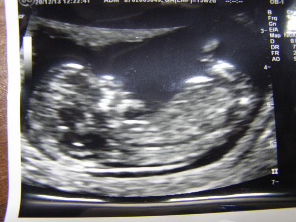 Poznáte pohlaví miminka?